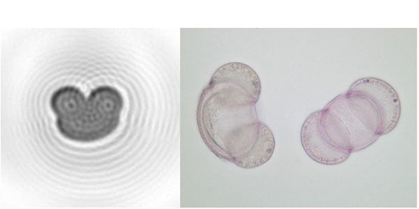 Beispiel von Pinus nigra und eine mikroskopische Aufnahme derselben Art